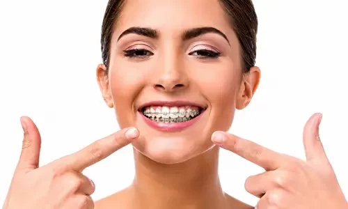 Ortodoncia-dental